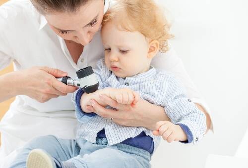 Kad ar mazuli ir jāiet pie dermatologa?